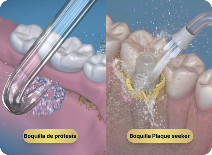 Boquillas para implantes Waterpik